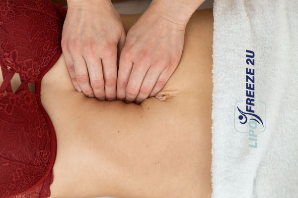 diastasis recti treatment Stratford-upon-Avon