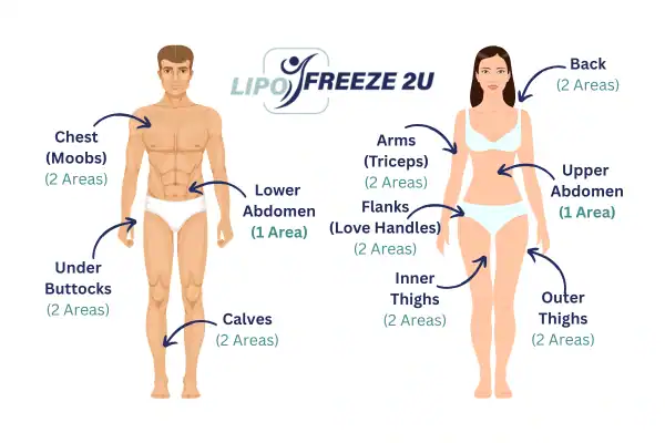 Areas you can have fat freezing treatment Stratford-upon-Avon