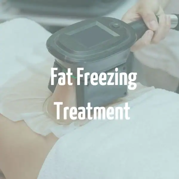 fat freezing treatment Stratford-upon-Avon