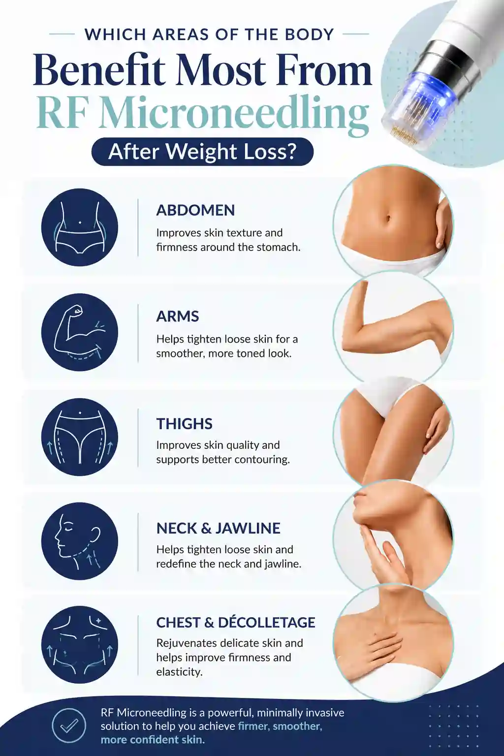 Which Areas of the Body Benefit Most From RF Microneedling After Weight Loss Stratford-upon-Avon