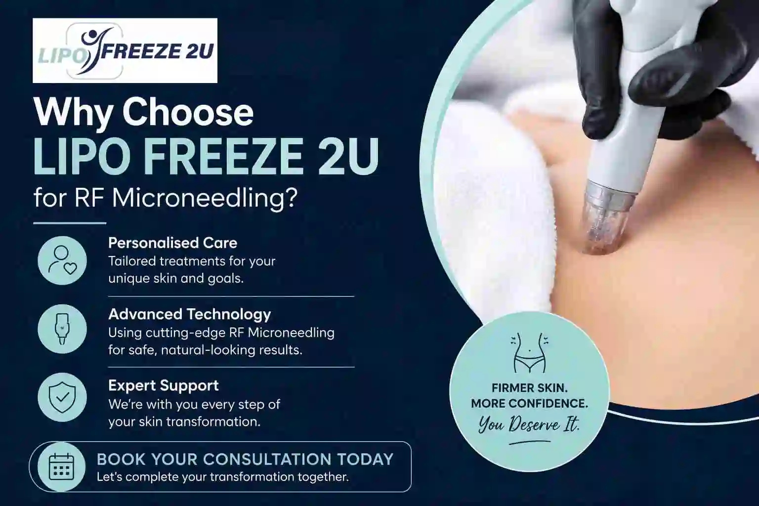 Why Choose LIPO FREEZE 2U for RF Microneedling Stratford-upon-Avon?